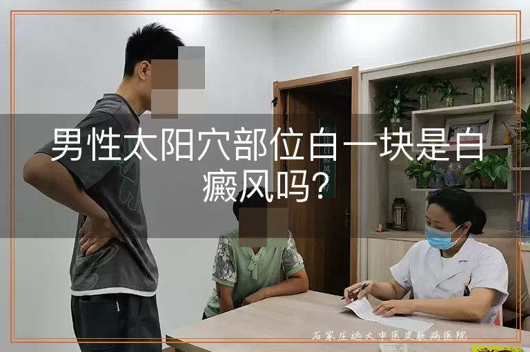 男性太阳穴部位白一块是白癜风吗？