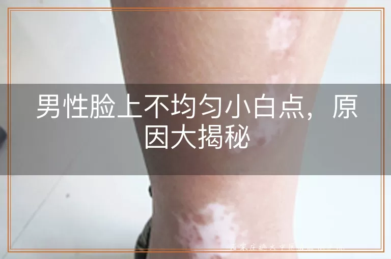 男性脸上不均匀小白点，原因大揭秘