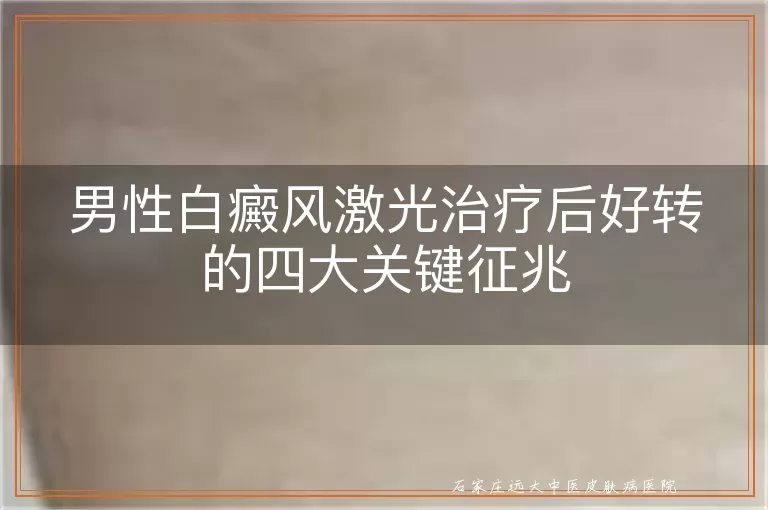 男性白癜风激光治疗后好转的四大关键征兆