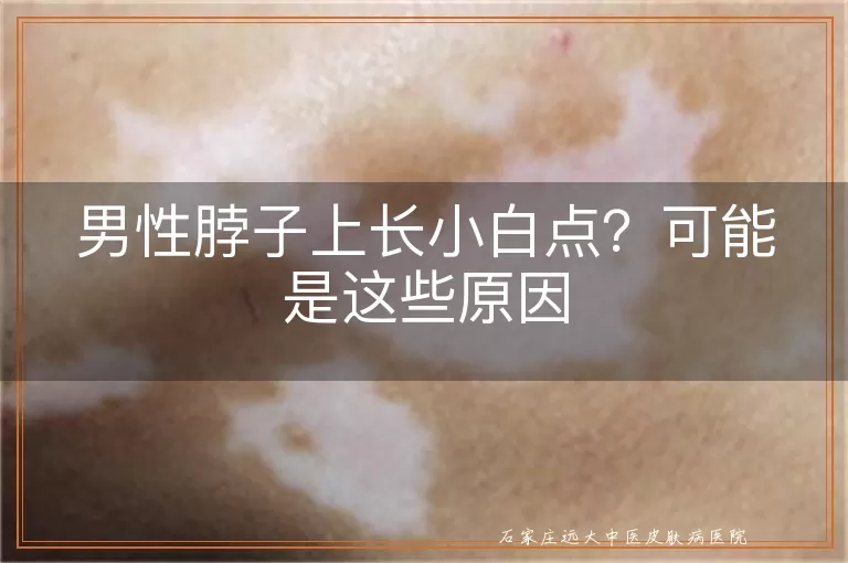 男性脖子上长小白点？可能是这些原因
