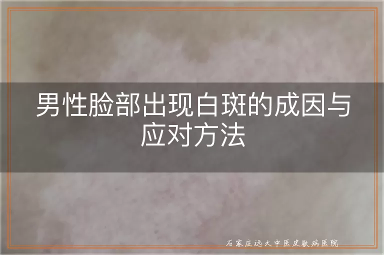 男性脸部出现白斑的成因与应对方法