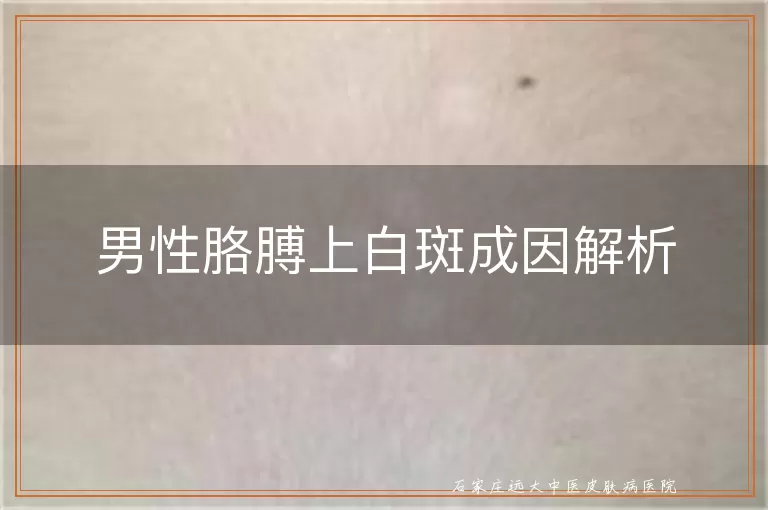 男性胳膊上白斑成因解析