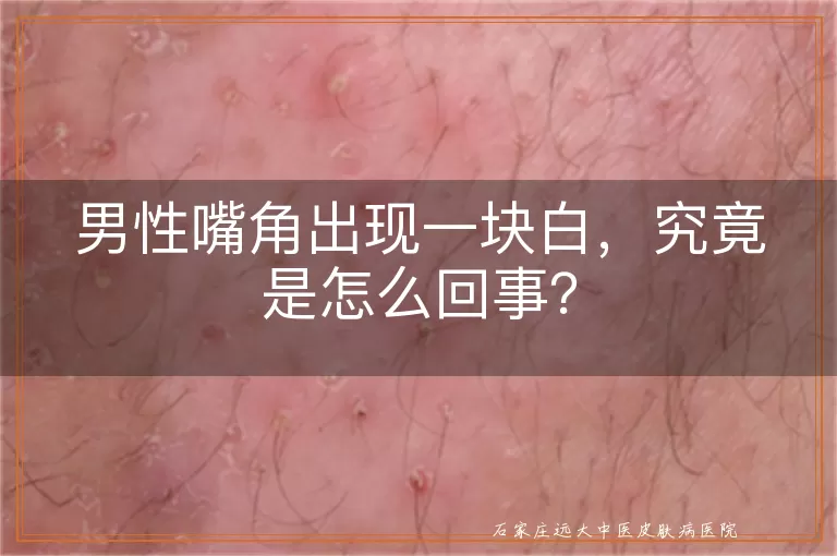 男性嘴角出现一块白，究竟是怎么回事？