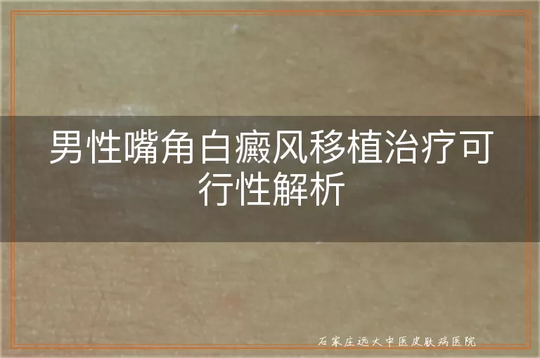 男性嘴角白癜风移植治疗可行性解析