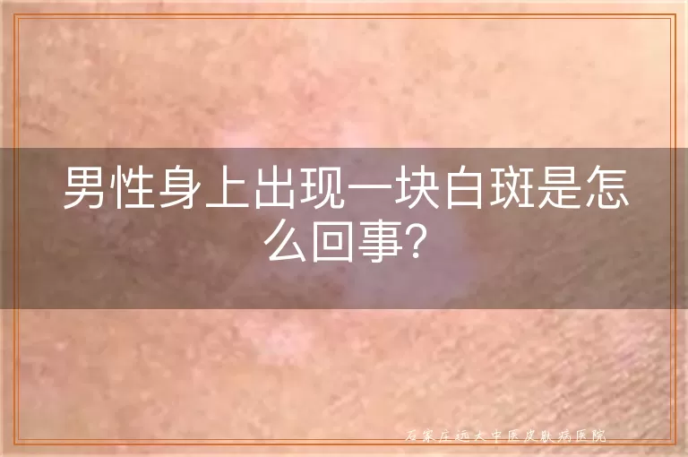 男性身上出现一块白斑是怎么回事？
