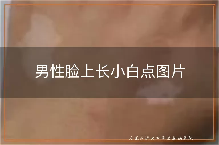 男性脸上长小白点图片