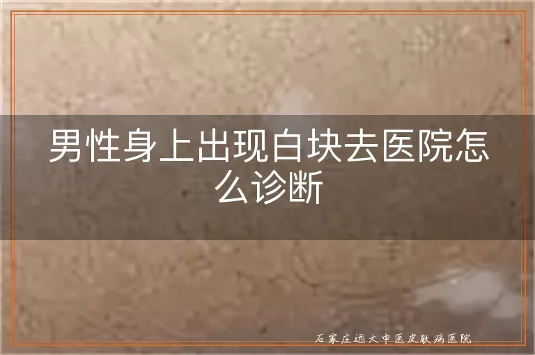 男性身上出现白块去医院怎么诊断