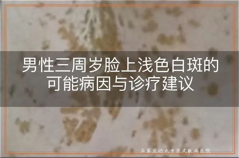 男性三周岁脸上浅色白斑的可能病因与诊疗建议