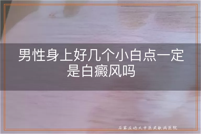 男性身上好几个小白点一定是白癜风吗