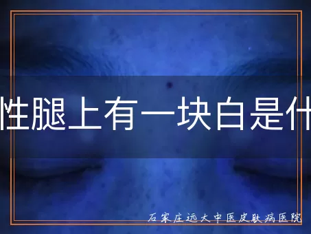 男性腿上有一块白是什么