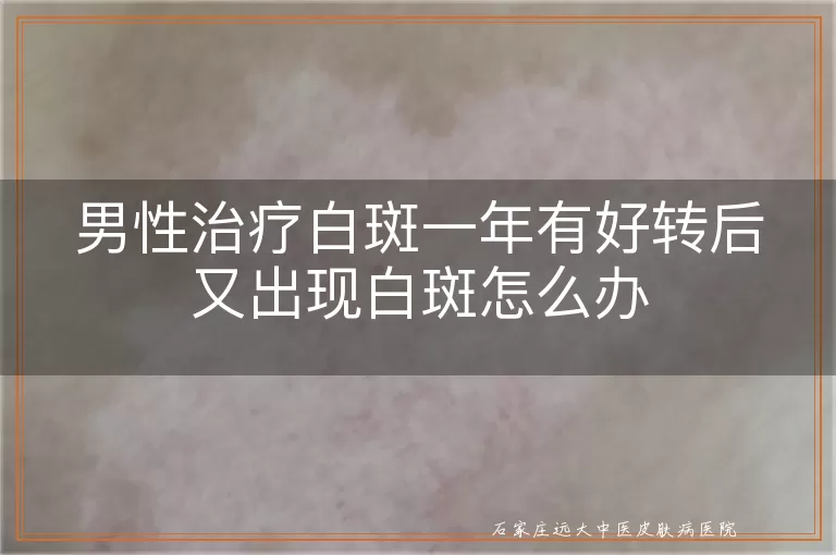 男性治疗白斑一年有好转后又出现白斑怎么办