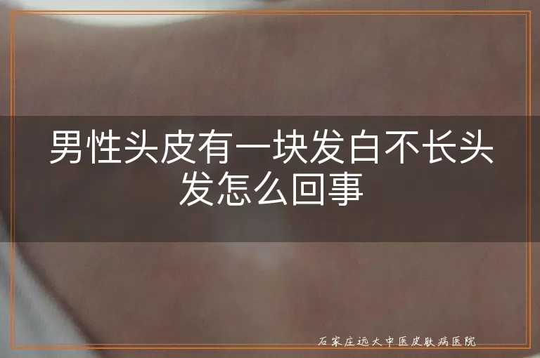男性头皮有一块发白不长头发怎么回事