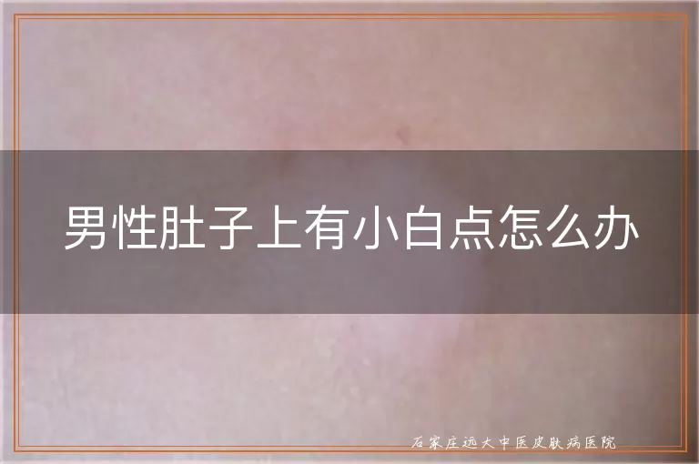 男性肚子上有小白点怎么办
