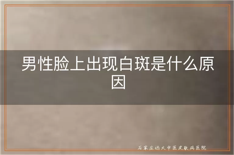 男性脸上出现白斑是什么原因