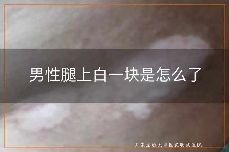 男性腿上白一块是怎么了