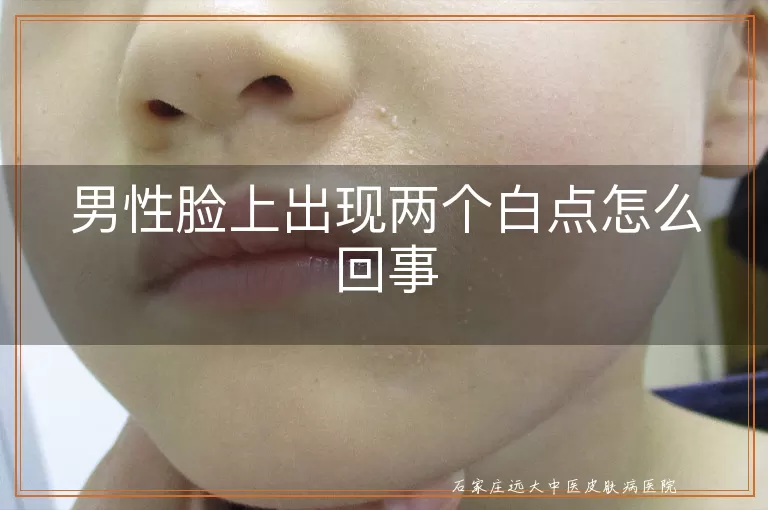 男性脸上出现两个白点怎么回事
