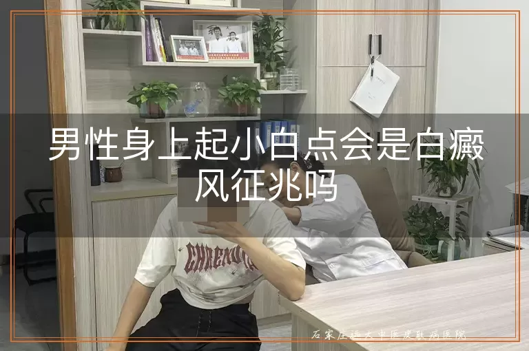男性身上起小白点会是白癜风征兆吗