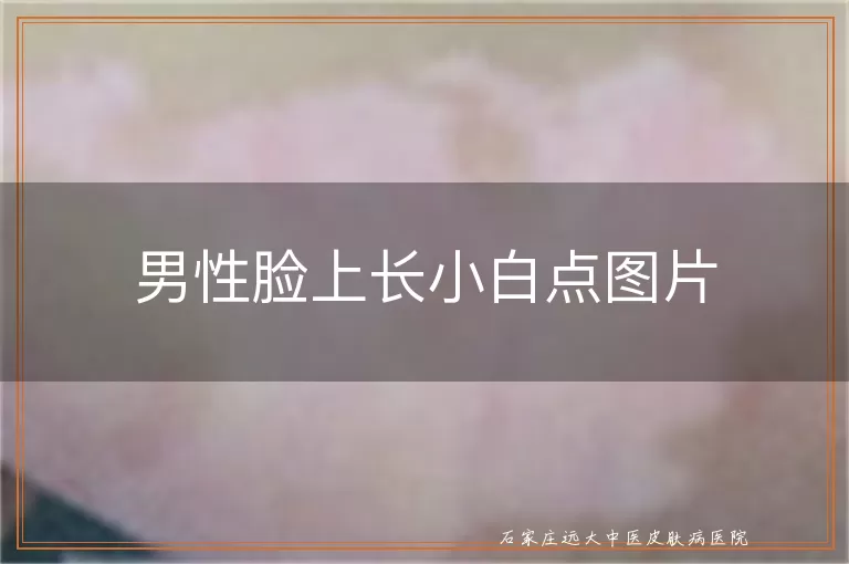 男性脸上长小白点图片