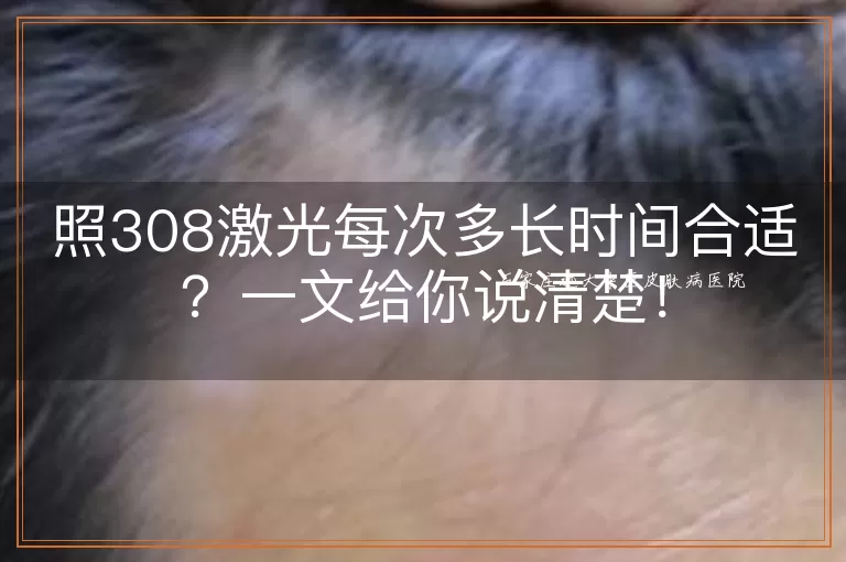 照308激光每次多长时间合适？一文给你说清楚！