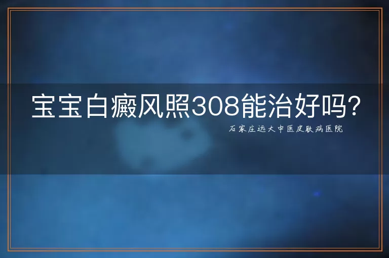 宝宝白癜风照308能治好吗？