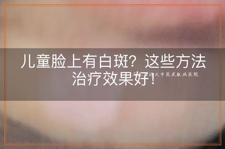 儿童脸上有白斑？这些方法治疗效果好！