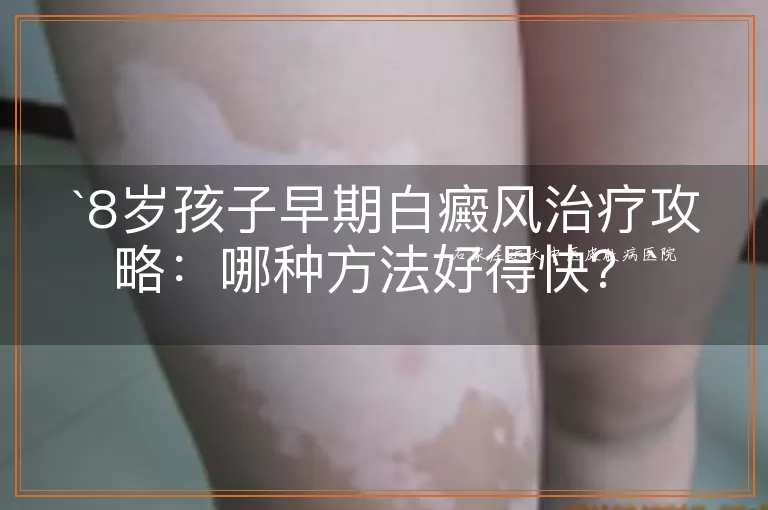 8岁孩子早期白癜风治疗攻略:哪种方法好得快?