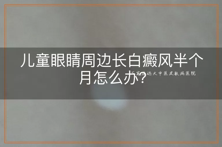 儿童眼睛周边长白癜风半个月怎么办？