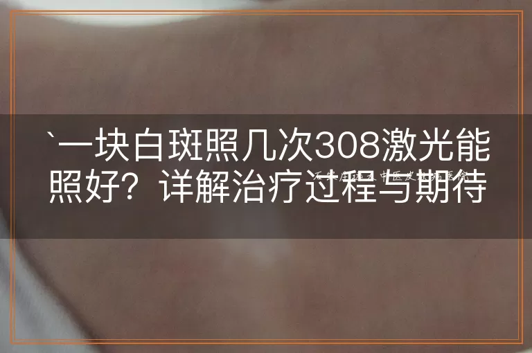 一块白斑照几次308激光能照好？详解治疗过程与期待