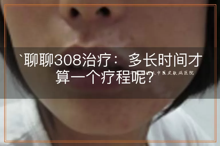 聊聊308治疗：多长时间才算一个疗程呢？