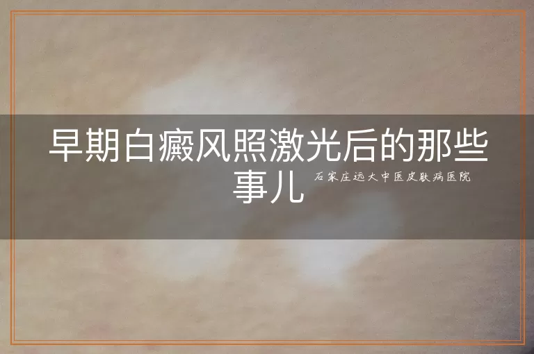 早期白癜风照激光后的那些事儿