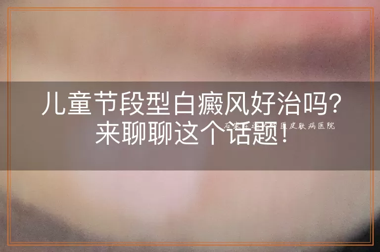 儿童节段型白癜风好治吗？来聊聊这个话题！