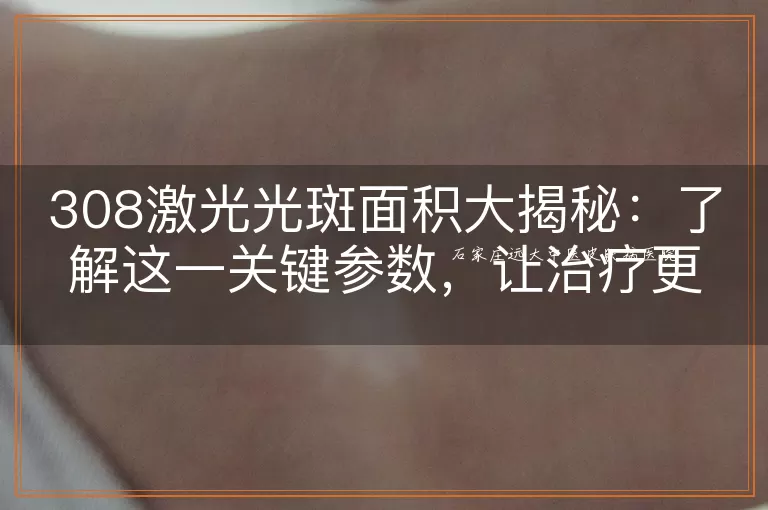308激光光斑面积大揭秘：了解这一关键参数，让治疗更精准