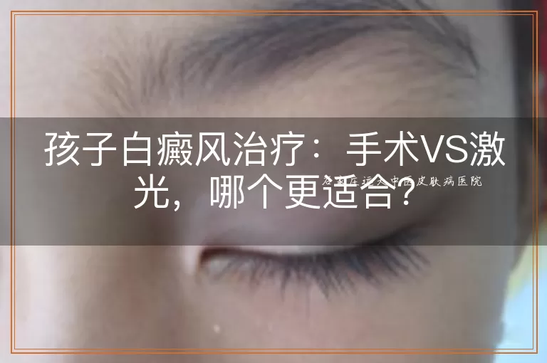 孩子白癜风治疗：手术VS激光，哪个更适合？