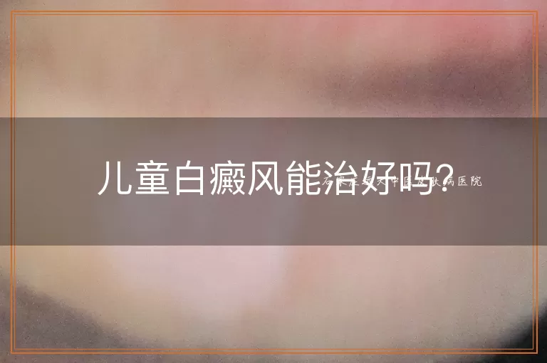 儿童白癜风能治好吗？