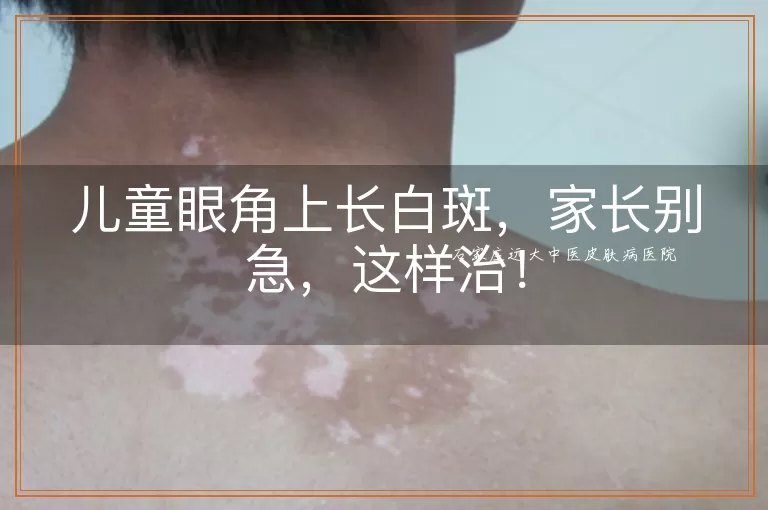 儿童眼角上长白斑，家长别急，这样治！