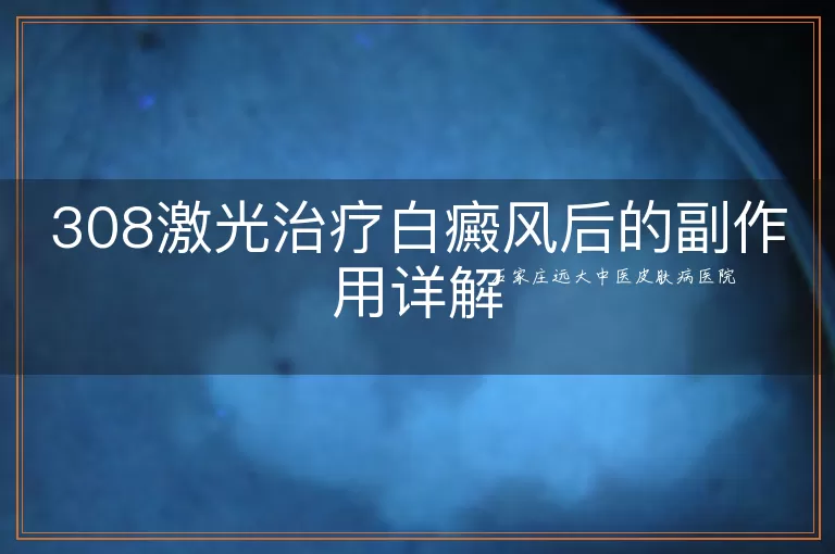 308激光治疗白癜风后的副作用详解