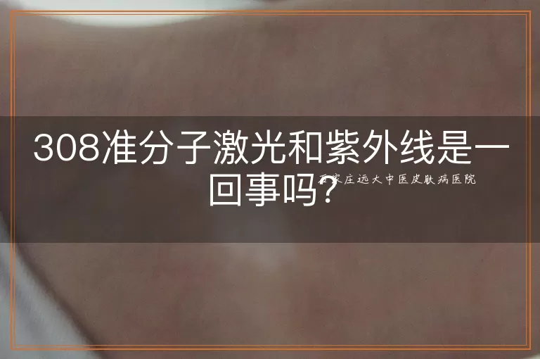 308准分子激光和紫外线是一回事吗？