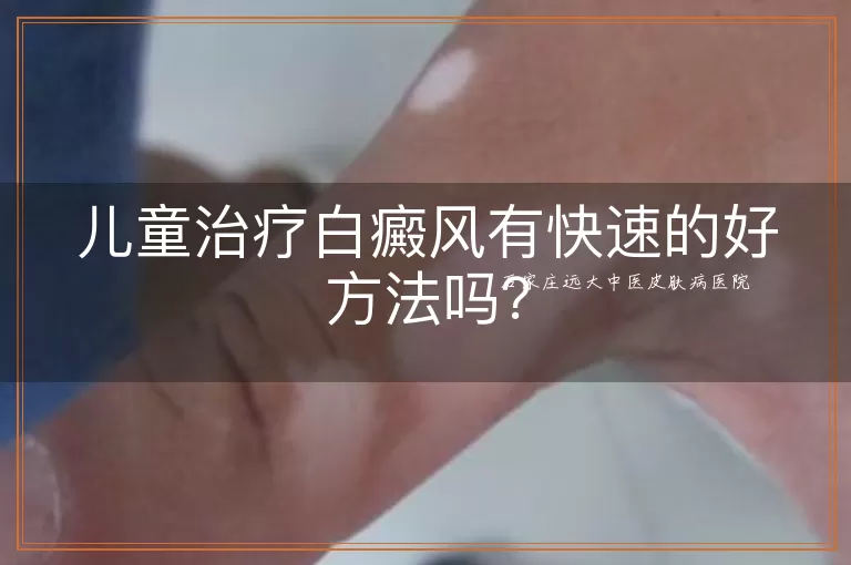 儿童治疗白癜风有快速的好方法吗？