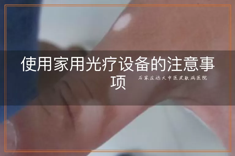 使用家用光疗设备的注意事项