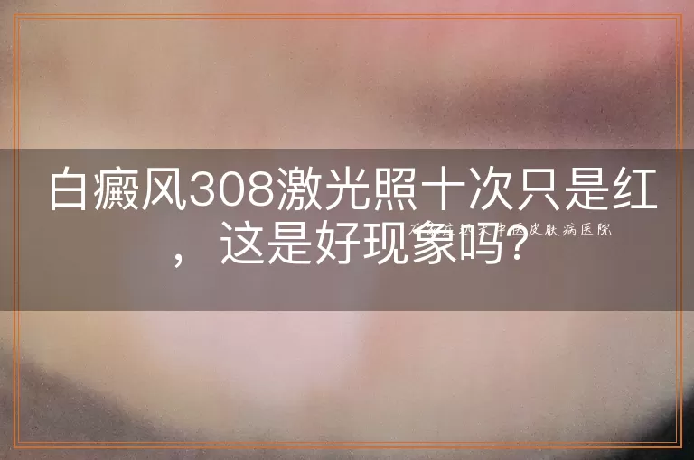 白癜风308激光照十次只是红，这是好现象吗？