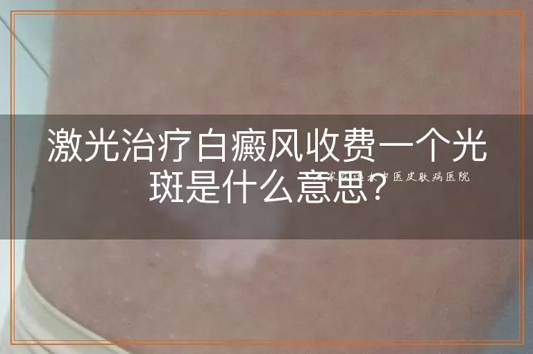 激光治疗白癜风收费一个光斑是什么意思？