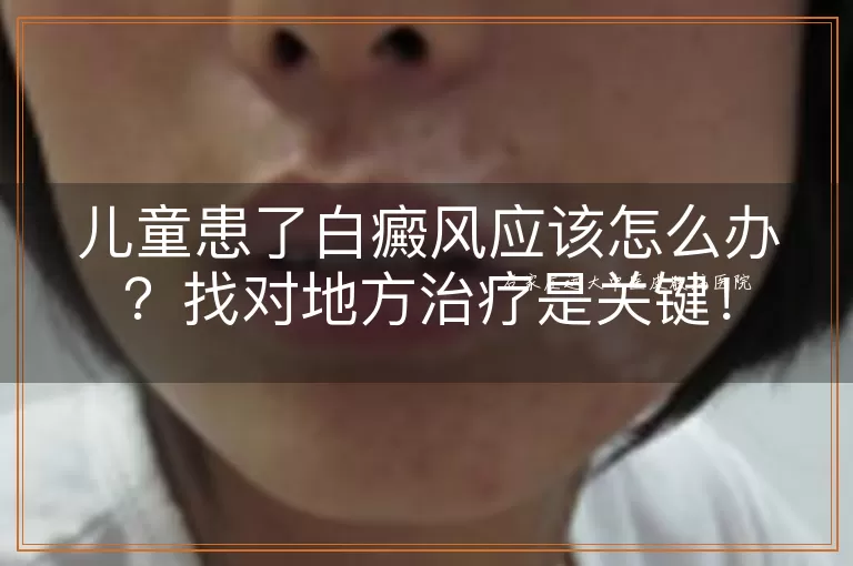 儿童患了白癜风应该怎么办？找对地方治疗是关键！