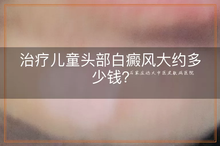 治疗儿童头部白癜风大约多少钱？