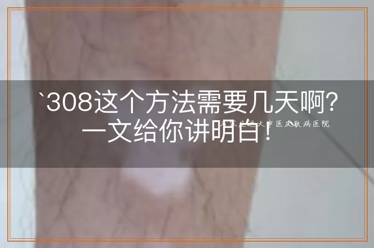 308这个方法需要几天啊？一文给你讲明白！