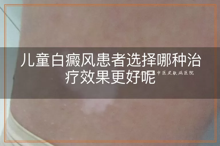 儿童白癜风患者选择哪种治疗效果更好呢