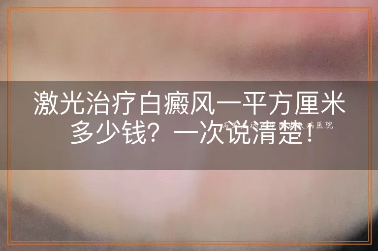 激光治疗白癜风一平方厘米多少钱？一次说清楚！