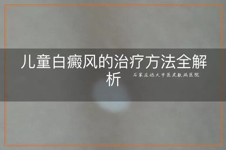 儿童白癜风的治疗方法全解析