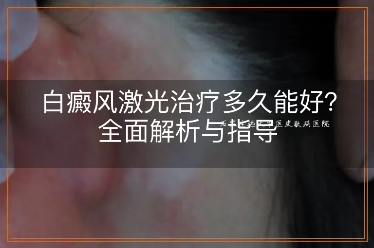 白癜风激光治疗多久能好？全面解析与指导