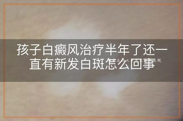 孩子白癜风治疗半年了还一直有新发白斑怎么回事