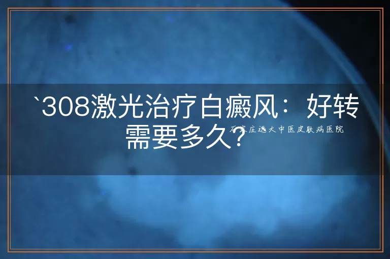 308激光治疗白癜风：好转需要多久？